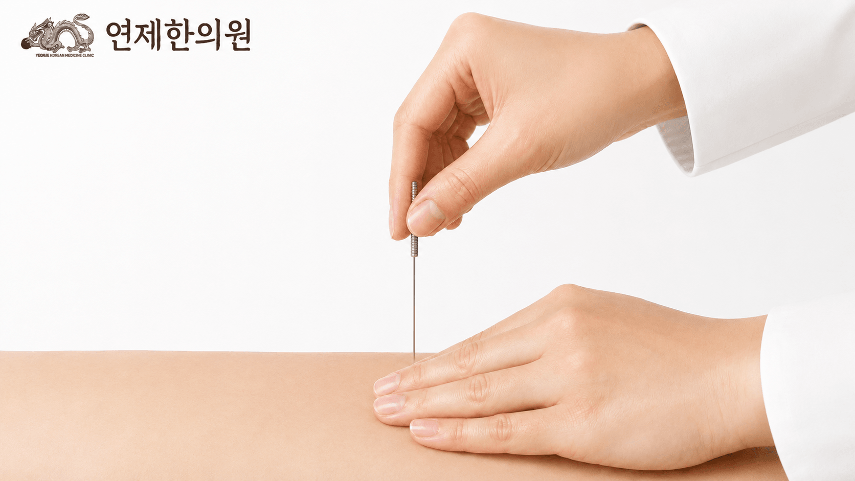 /images/02-korean-medicine/km-acupuncture.png 침치료 시술 모습