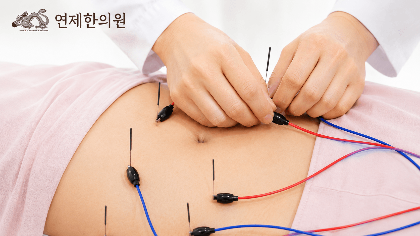 /images/02-korean-medicine/km-electro.png 전침치료 시술 모습