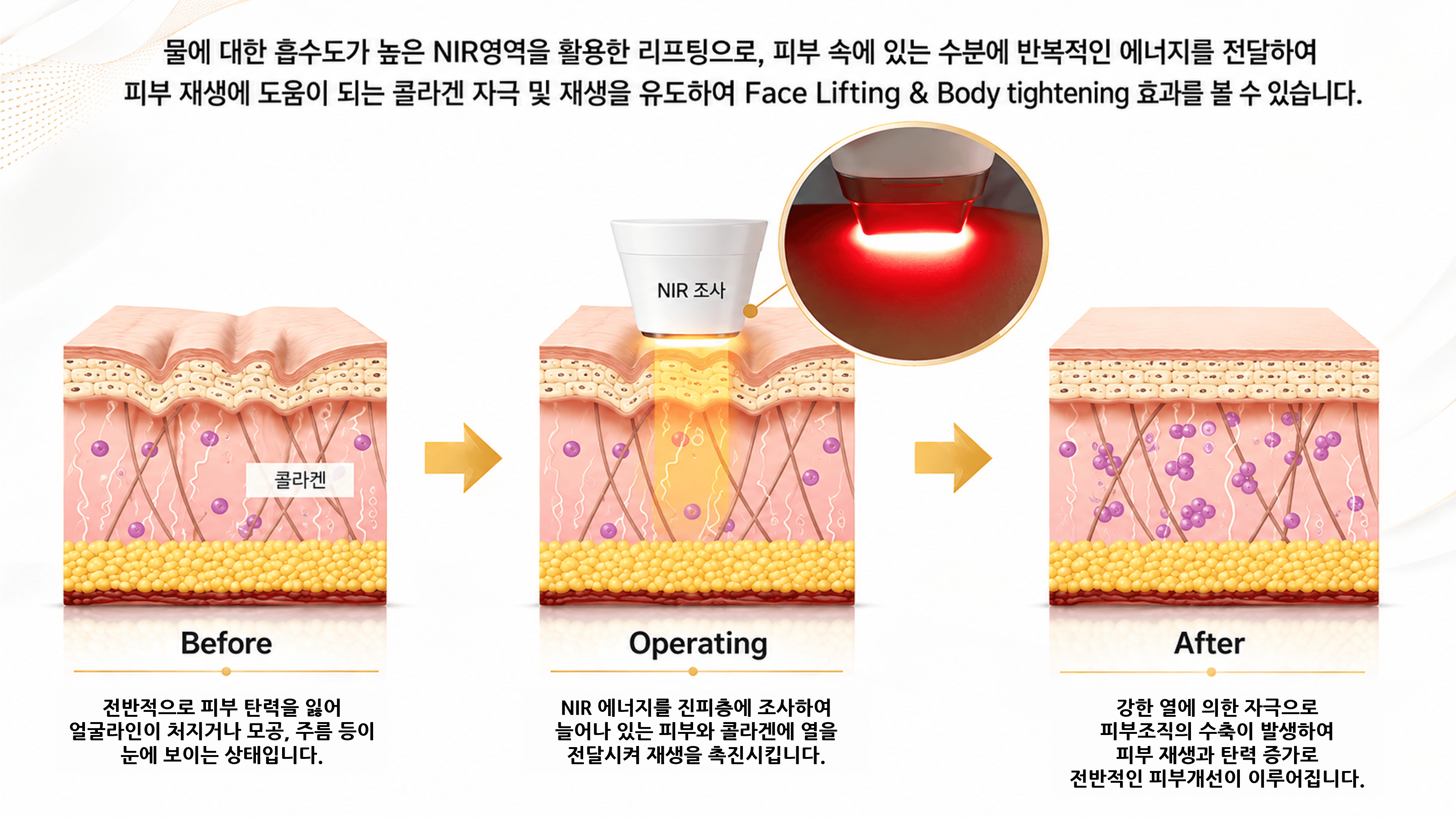 /images/06-skincare/ncore-effect.png N.CORE PRIME 효과 — Before · Operating · After