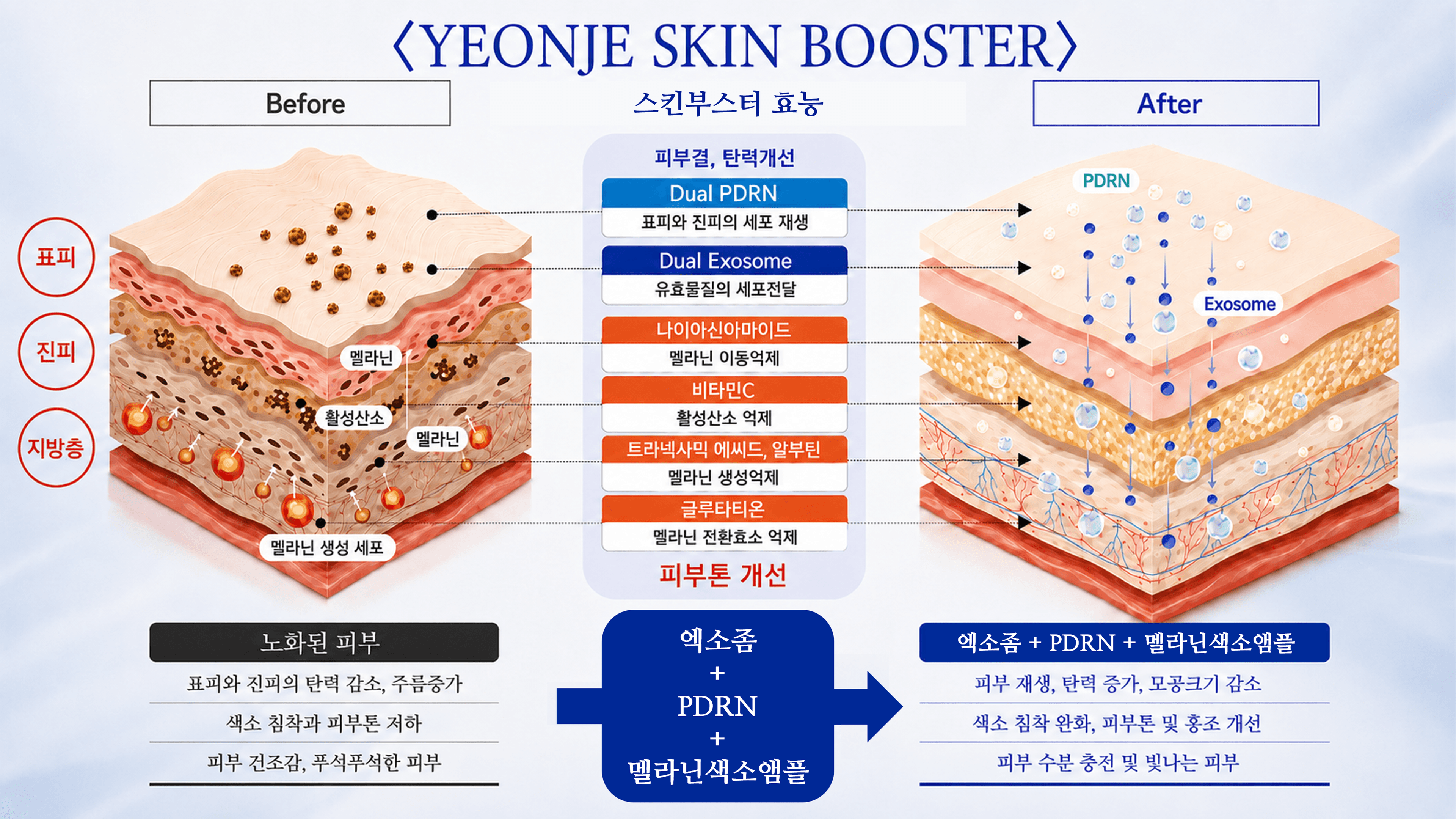 /images/06-skincare/skinbooster-diagram.png 스킨부스터 효과 — 엑소좀 + PDRN + 멜라닌색소앰플 Before / After