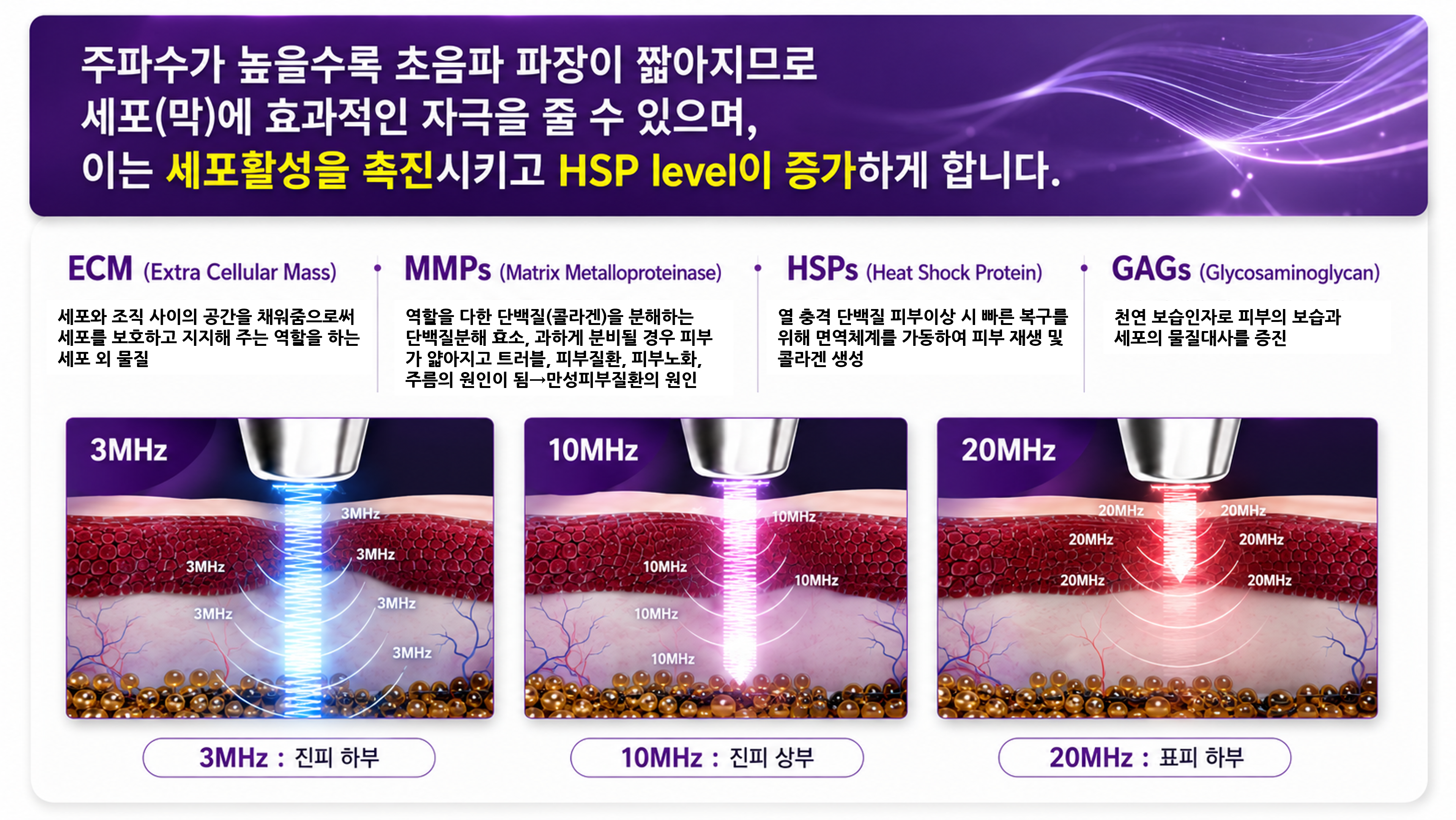 /images/06-skincare/waterdrop-effect.png 물방울리프팅 효과 — ECM · MMPs · HSPs · GAGs · 3MHz/10MHz/20MHz 파장