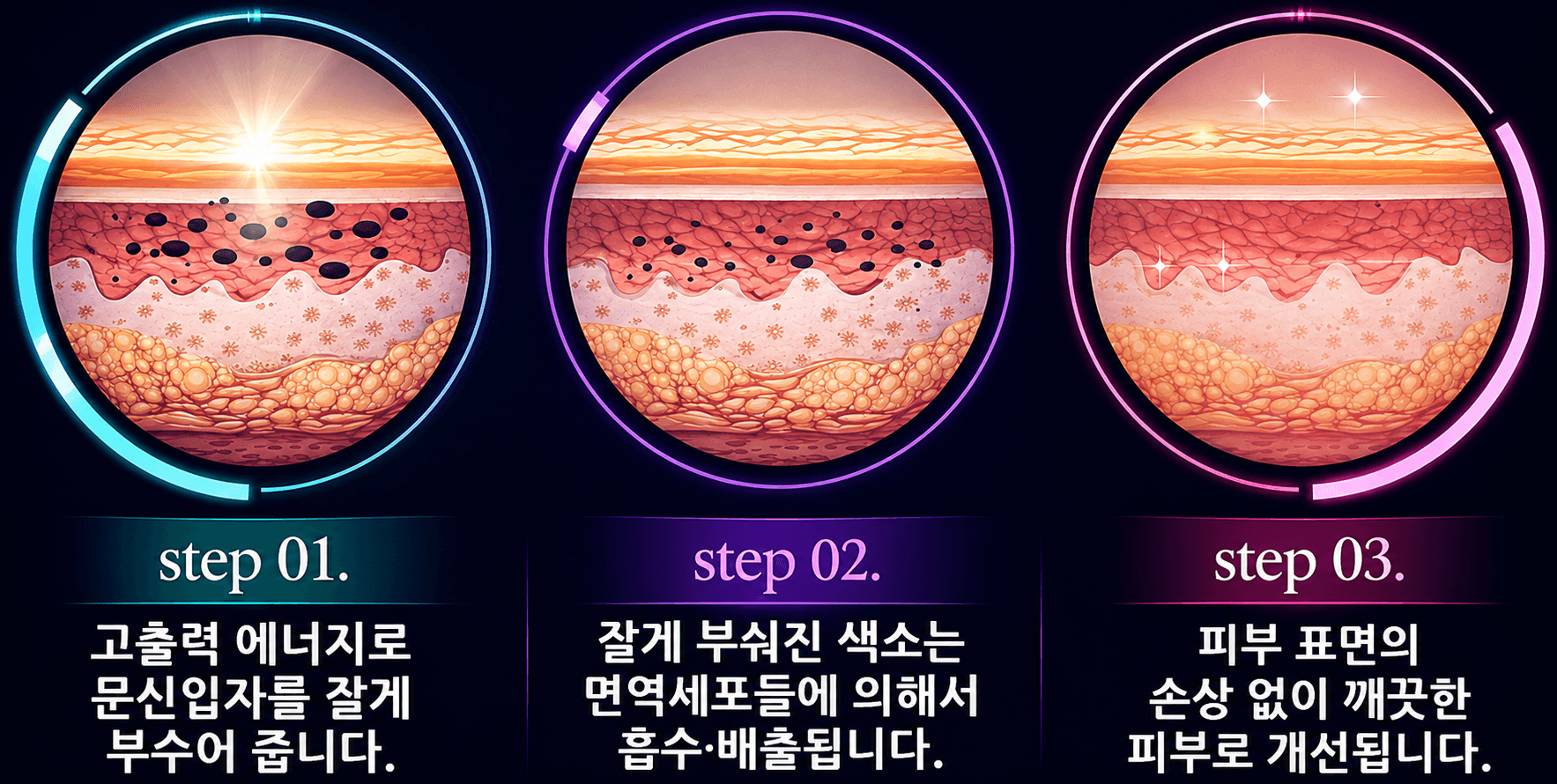 /images/08-tattoo-removal/tattoo-steps.png 피코레이저 문신 제거 3단계 원리 (step 01 문신입자 분쇄 → step 02 면역세포 흡수·배출 → step 03 깨끗한 피부로 개선)