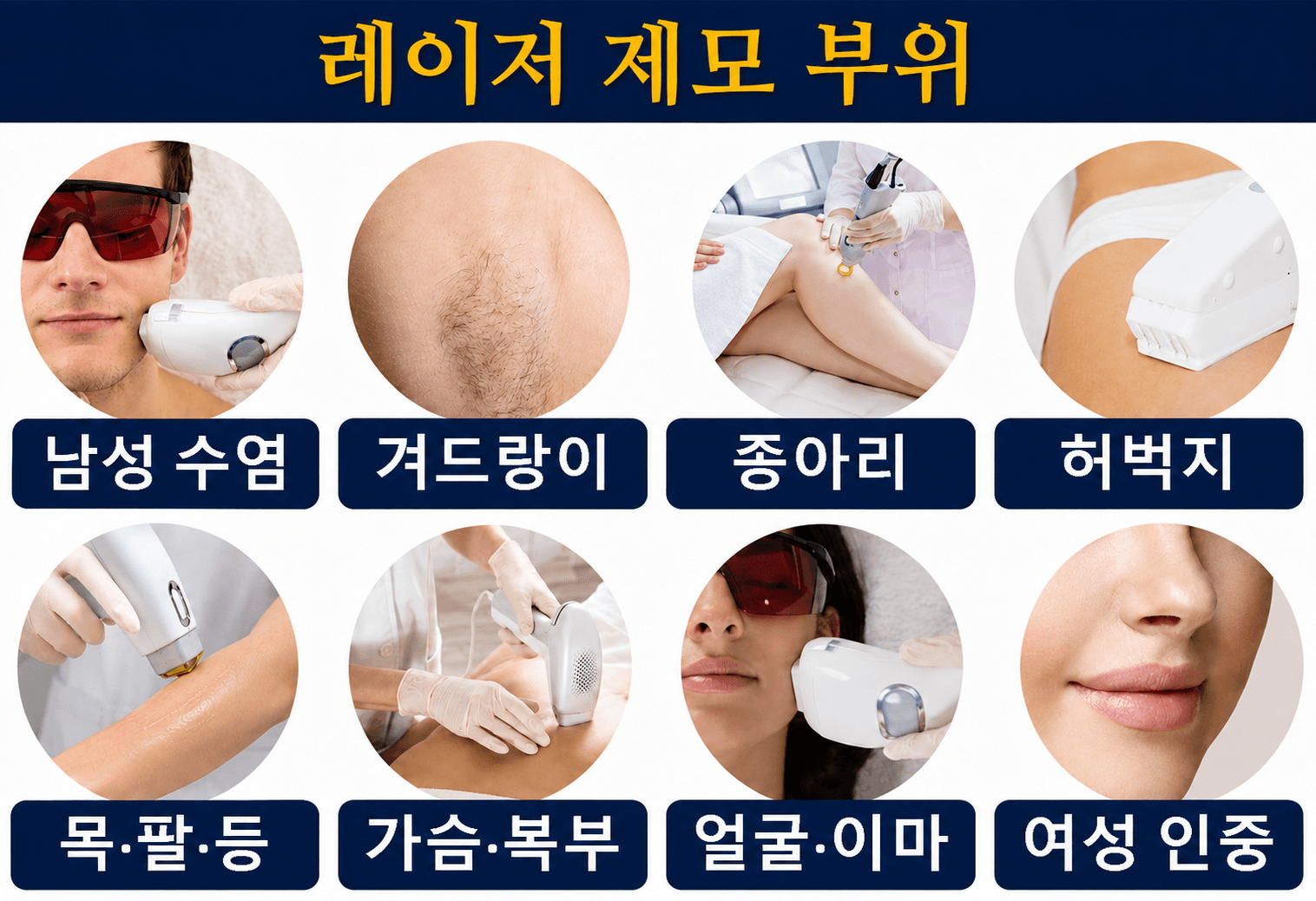 /images/10-hair-removal/hairremoval-areas.png 레이저 제모 부위 — 남성 수염 · 겨드랑이 · 종아리 · 허벅지 · 목·팔·등 · 가슴·복부 · 얼굴·이마 · 여성 인중
