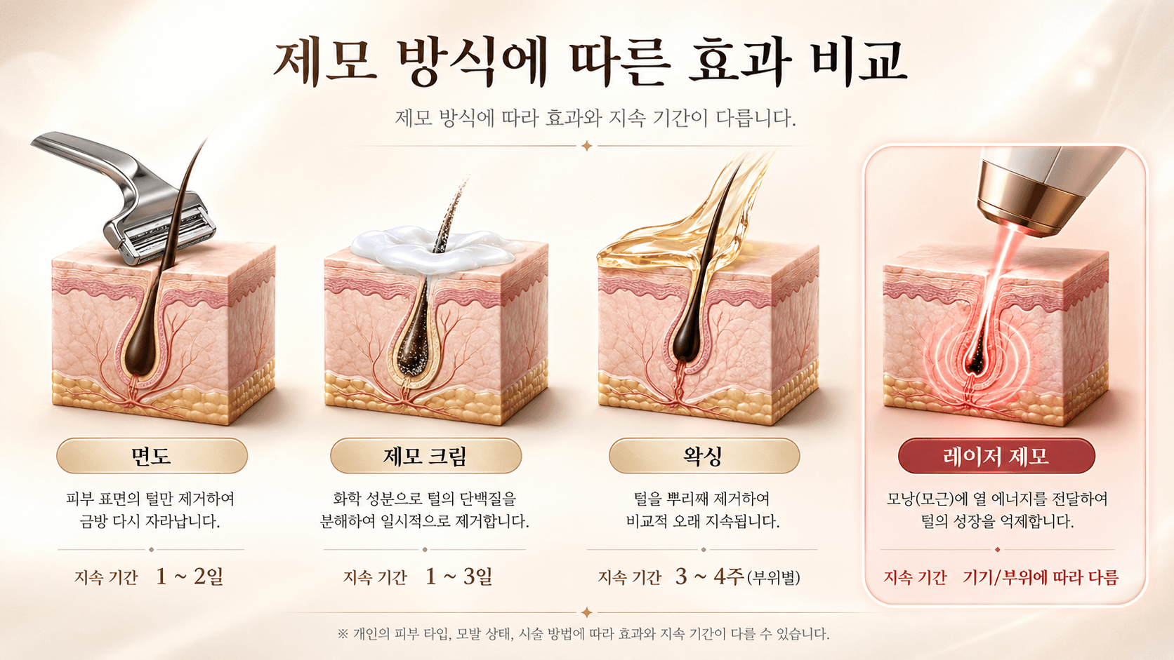 /images/10-hair-removal/hairremoval-comparison.png 제모 방식에 따른 효과 비교 — 면도 · 제모크림 · 왁싱 · 레이저 제모